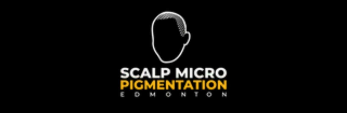 Scalp Micro Pigmentation Edmonton Cover Image