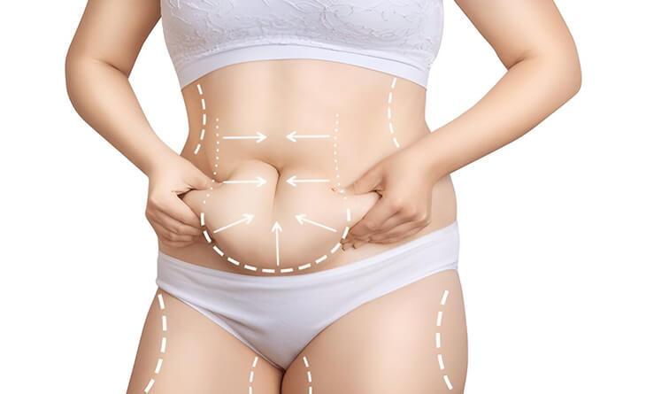 The Cost of a Tummy Tuck: What to Expect and How to Plan | APSense.com