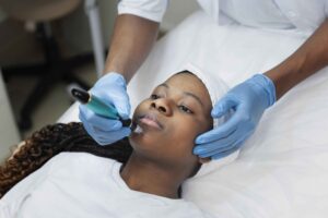 Microneedling Mississauga | Nebula Wellness ?✅
