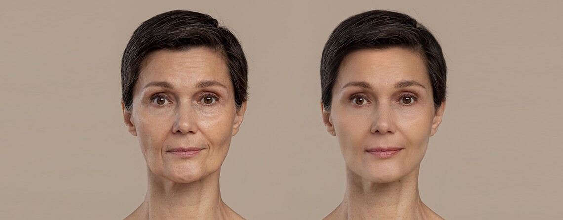 What Is Facial Contouring Surgery?