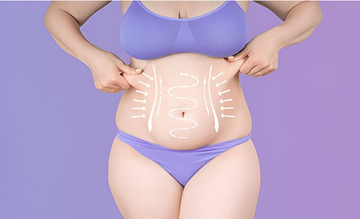 Tummy Tuck Surgery in Delhi | Cost & Procedure - Med Esthetiks