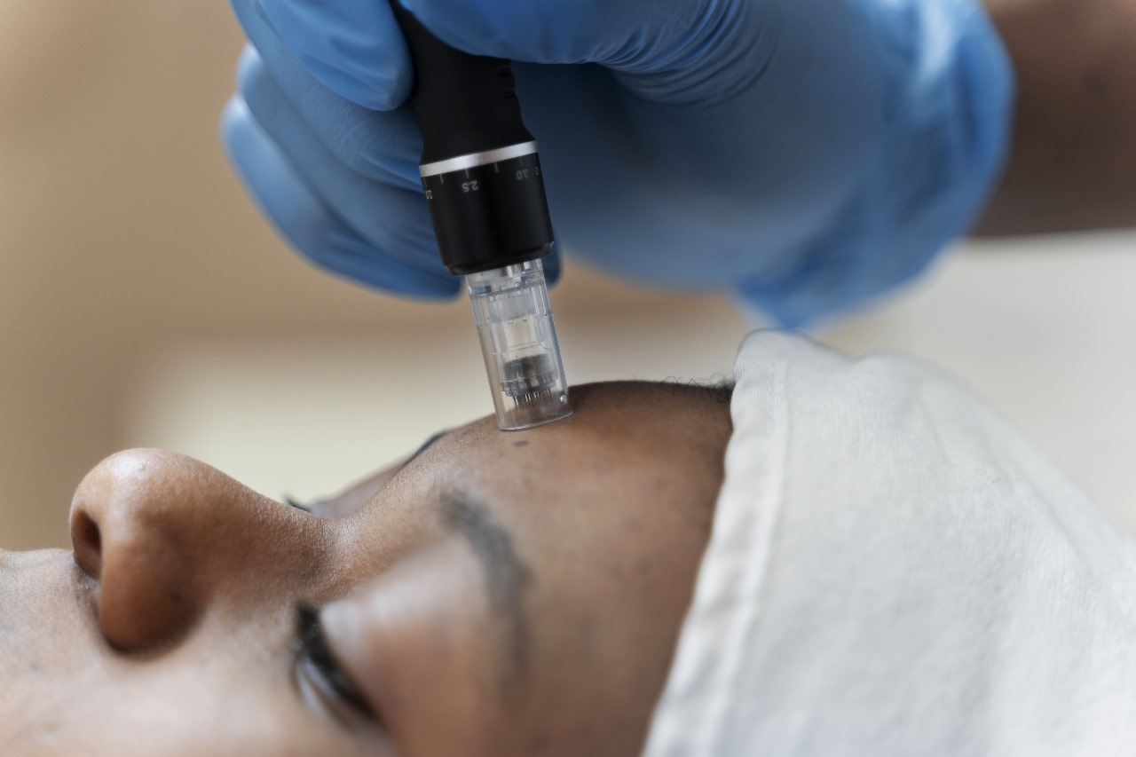 A Guide to Botox Treatments in Mississauga - Jordan Sheel