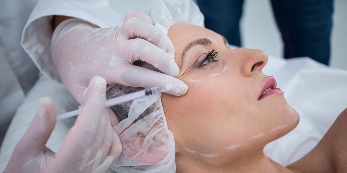 Scar Removal Treatments in Mississauga