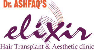 Best FUE Hair Transplant Center in Islamabad Pakistan