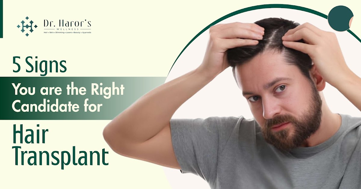 5 Signs You are the Right Candidate for Hair Transplant