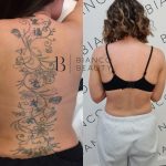 Profesjonalne usługi usuwania tatuaży laserem w Sopocie