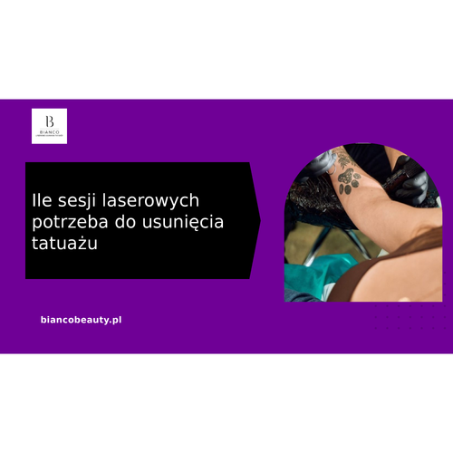 Ile sesji laserowych potrzeba do usunięcia tatuażu