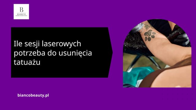 Ile sesji laserowych potrzeba do usunięcia tatuażu | PPTX