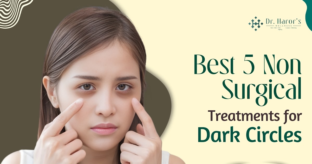 Best 5 Non-Surgical Treatments for Dark Circles