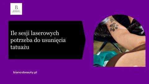 Ile sesji laserowych potrzeba do usunięcia tatuażu