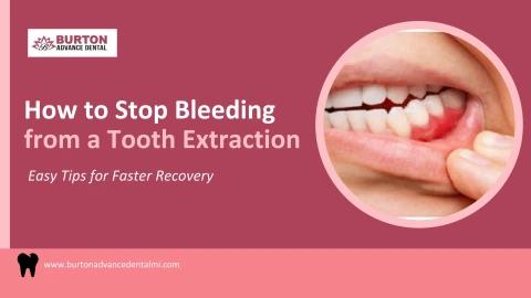 How to Stop Bleeding from a Tooth Extraction: Easy Tips for Faster Recovery
