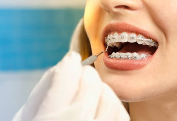 Your Path to a Healthier Smile: Choosing the Right Dentist in Clarkston MI